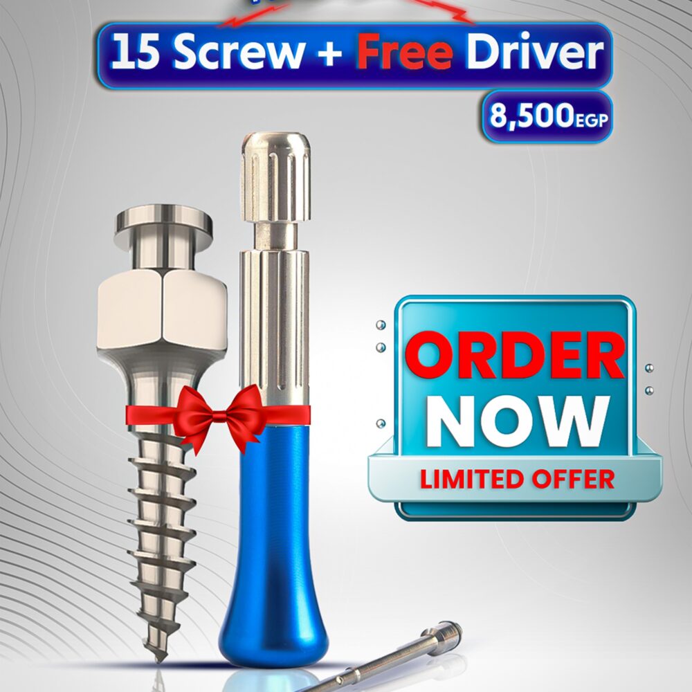 15 screw + free Delivery